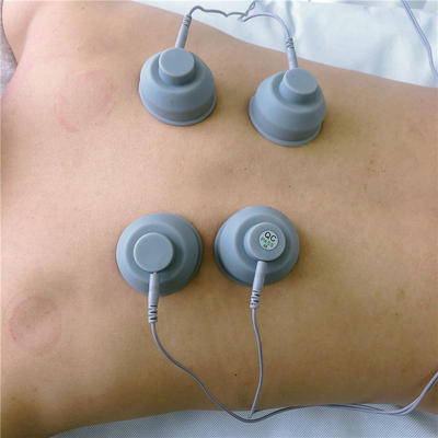 Mobile Muscle Relaxer Machine , Electric Shock Machine For Muscles Easy Use