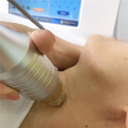 Strectch Marks Removal 45 Degree Microneedling Frational RF