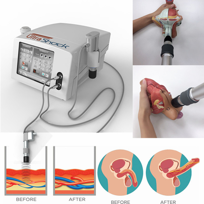 Non Invasive 12 Heads Ed Ultrasound Pain Relief Machine