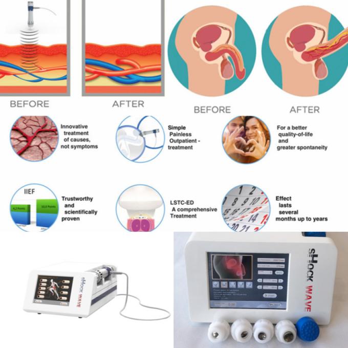 Home Shockwave Therapy Machine For Erectile Dysfunction